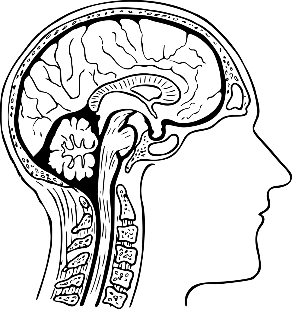 sacramento cerebral anoxia