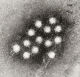 Sacramento Area Hepatitis A Lawyer