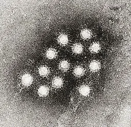 Sacramento Area Hepatitis A Lawyer