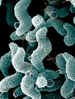 Sacramento Area Campylobacter Food Poisoning Lawyer