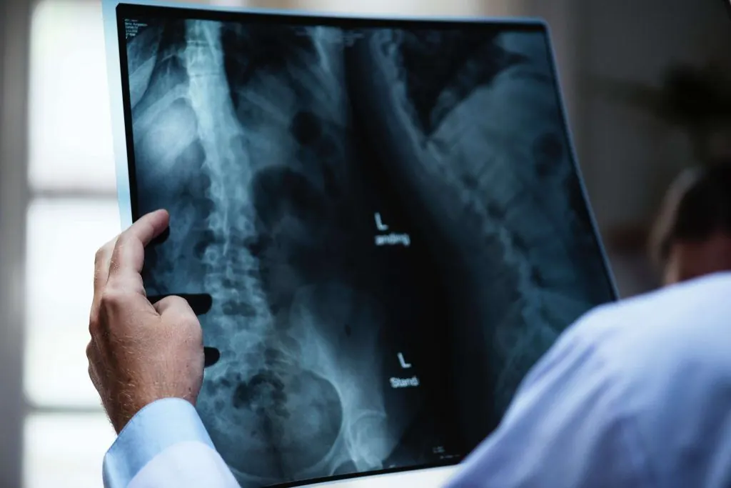 Common Causes of Spinal Cord Injuries