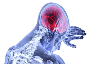 Motor Deficits Following Traumatic Brain Injuries